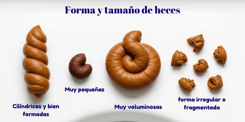 forma y tamaño de heces