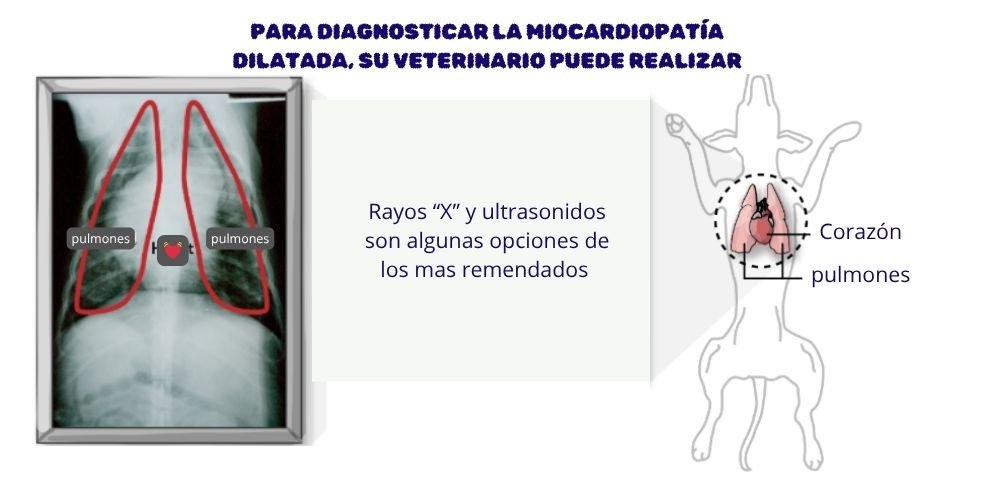 diagnostico de la miocardiopatía dilatada